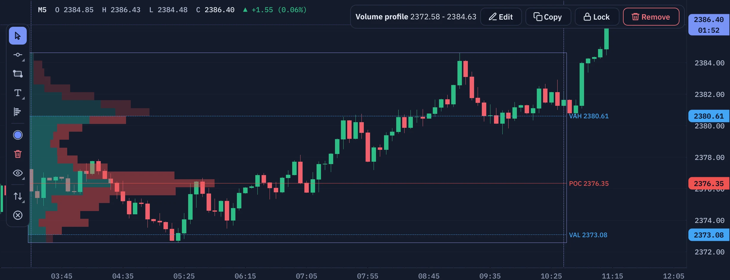 A selected volume profile with its Edit, Lock and Remove toolbar